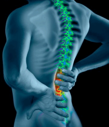 back injury lawsuit