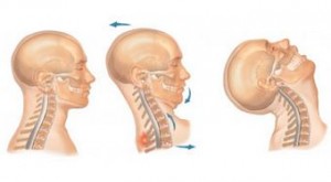 whiplash injury case